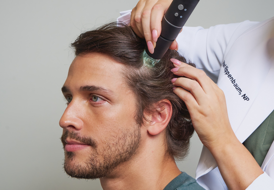 A male patient undergoing a PRP hair treatment consultation using a scalp cam in NYC.